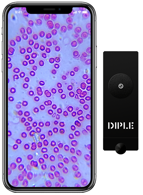 DippleIMG Dipple Phone